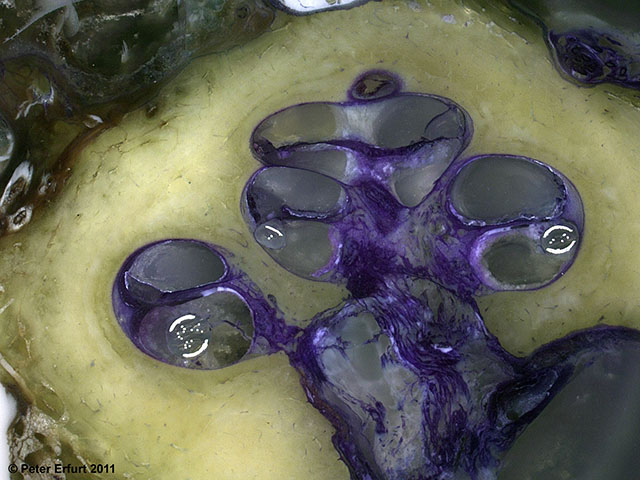 Mittlerer Abschnitt der menschlichen Cochlea (30-fache Vergrößerung) mit implantierter Elektrode (und ohne Schadensprofil)