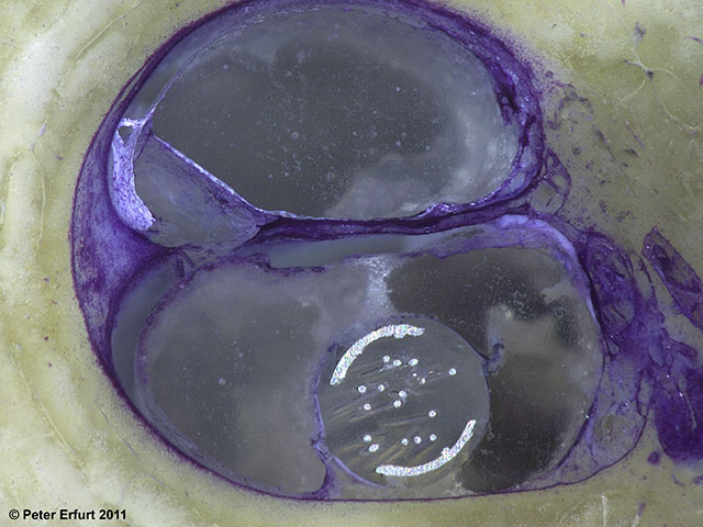 Detailansicht des linken Bildes (100-fache Vergrößerung)